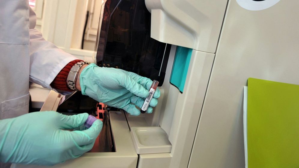 NADA testet Drid Blood Spot-Technik - Bildquelle: AFP/SID/FABRICE COFFRINI
