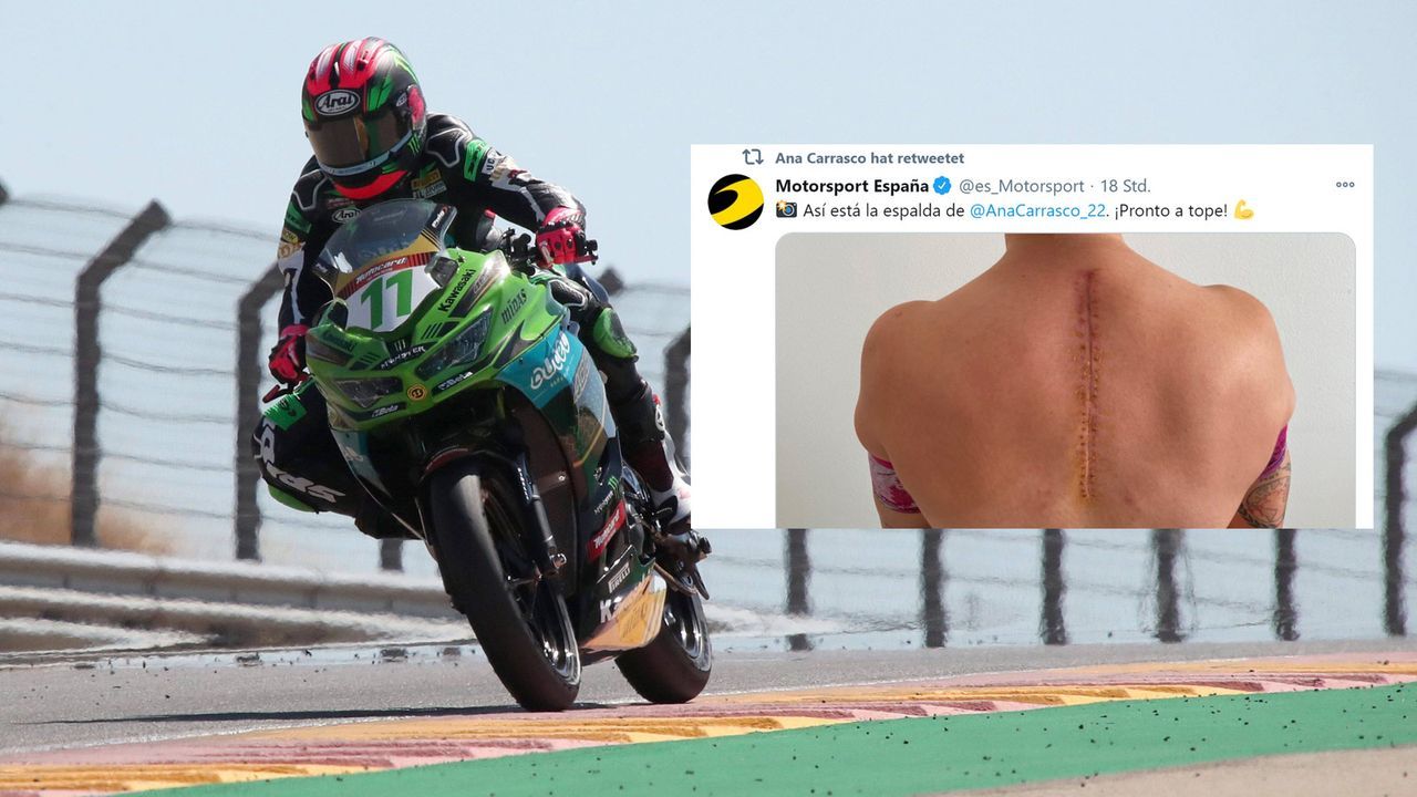 Nach OP: Spanische Motorradfahrerin zeigt riesige Rückennarbe - Bildquelle: imago images/twitter.com/es_Motorsport