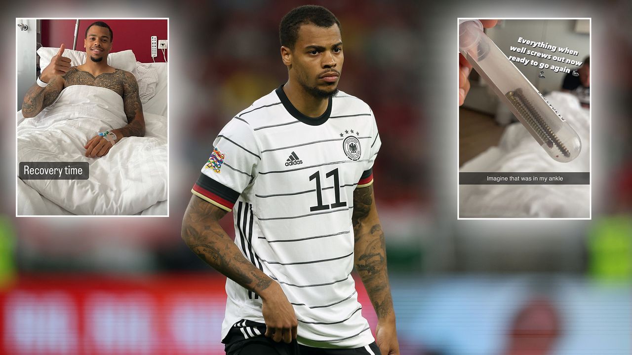 Lukas Nmecha: Nach den Länderspielen wurden die Schrauben aus dem Knöchel entfernt - Bildquelle: Getty Images/instagram@l.nmecha_