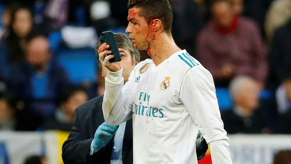 Ronaldo Schaut Sich Platzwunde Mit Handy An