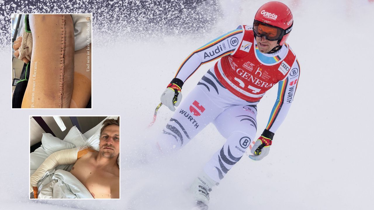 36 Klammern! Deutscher Skistar Josef Ferstl zeigt Mega-Narbe - Bildquelle: imago/instagram@josef_ferstl