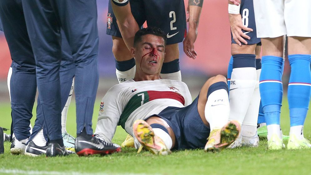 Cristiano Ronaldo lag blutend am Boden - Bildquelle: Imago