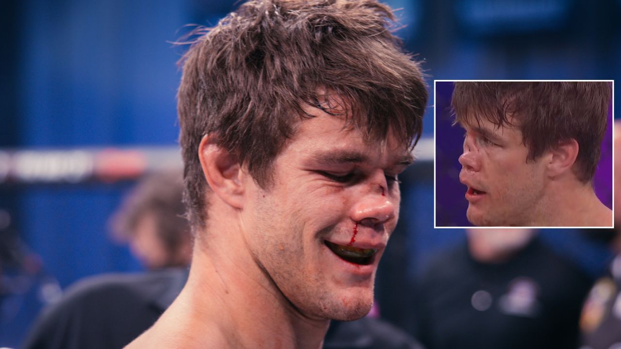MMA-Star Derek Anderson mit komplett kaputter Nase - Bildquelle: twitter@BellatorMMA/twitter@Rjgot9lives
